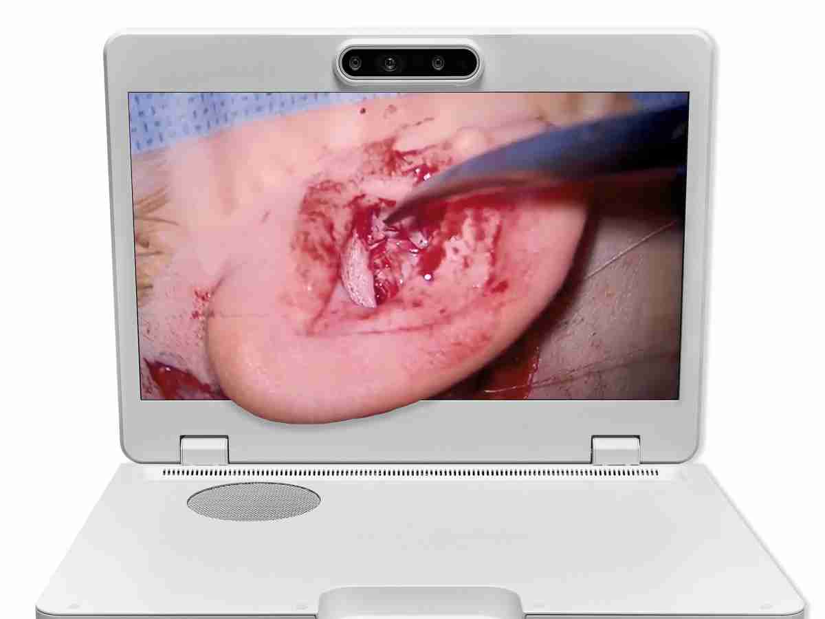 达擎之＂Heads-up 3D显微手术显示系统＂，，整合4K裸眼3D显示及眼球追踪系统，，，具备快速追踪人眼移动位置功能，，，，减轻医师长时间维持固定姿势的负担，，让医师能有更宽广清晰的3D立体视野及更舒适的姿势来执行手术。。。。